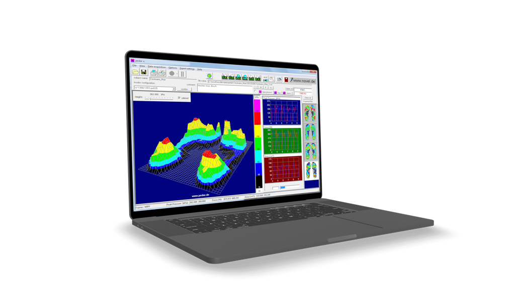 foot pressure mapping insole - gait analysis - pedar