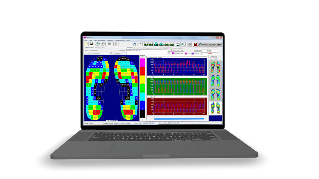 PEDAR - the most accurate foot pressure measurement insole